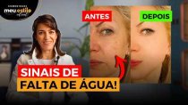 Imagem PELE e CABELOS Saudáveis apenas Bebendo ÁGUA